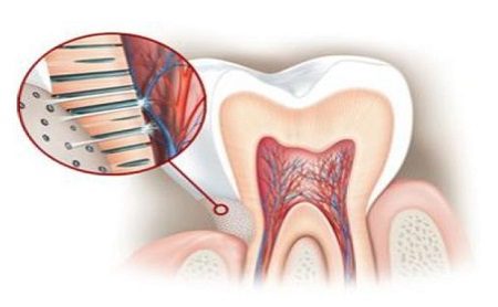 sensibilidad-dental-espacio-dental-jaen