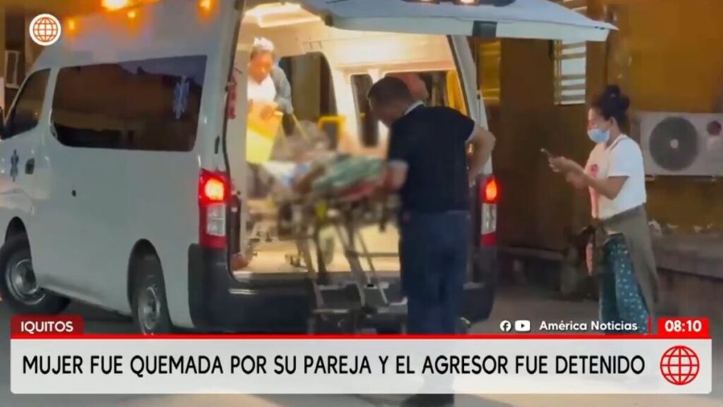 Iquitos: Mujer sufre graves quemaduras tras presunto intento de feminicidio